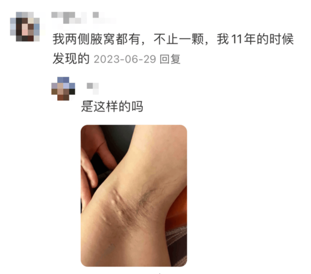 腋窝下的疙瘩，到底是个啥？