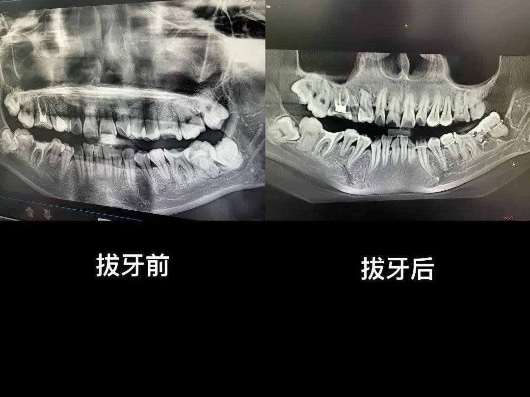 “痛到崩溃”！市卫健委回应“女子在医院跳楼”