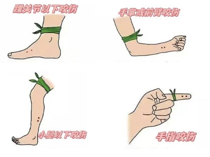 上海七旬老人小区散步被毒蛇咬伤，女儿崩溃：医院怎么选……这份救命指南快收好！